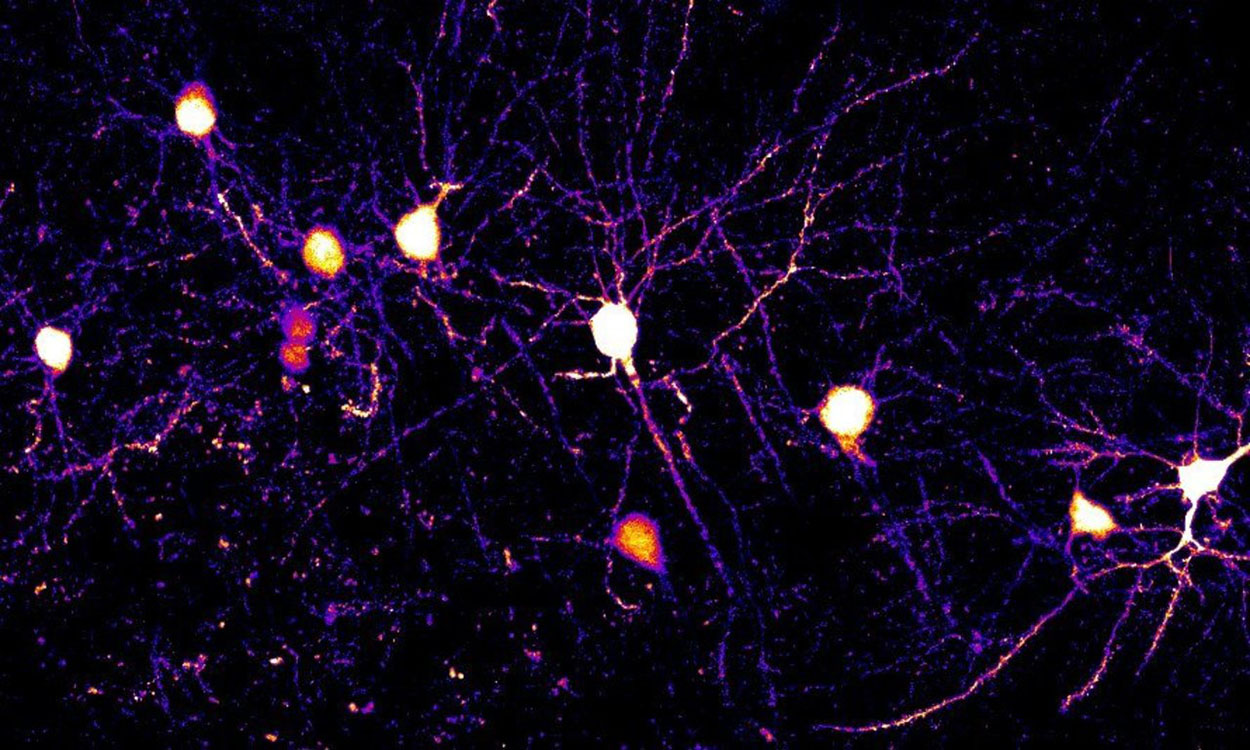 Microscopic image of synapses